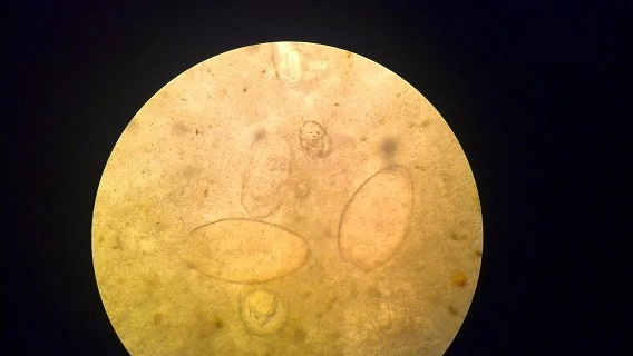 血吸虫成虫显微镜图片图片